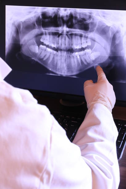 Best Emergency Treatment for Dental Infections or Abscesses in Napa, CA