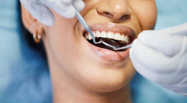 Best After-Hours Dental Trauma Care in Napa, CA