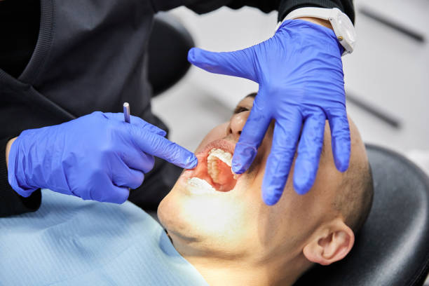 Best Urgent Care for Lost Fillings or Crowns in Napa, CA